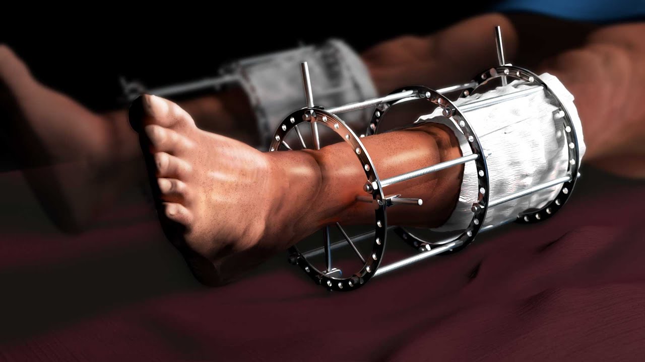 Experimentando cambios extremos: de baja a alta en un solo día